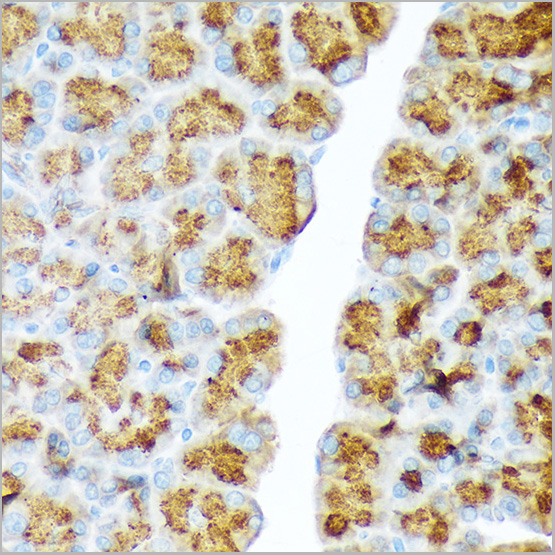 product-image-AAA28523_IHC3.jpg