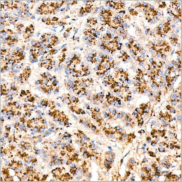 product-image-AAA28526_IHC3.jpg