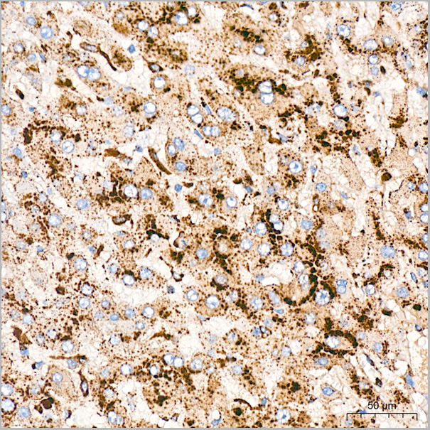 product-image-AAA28526_IHC4.jpg