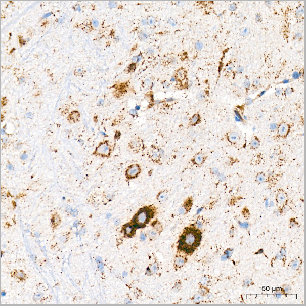 product-image-AAA28526_IHC6.jpg