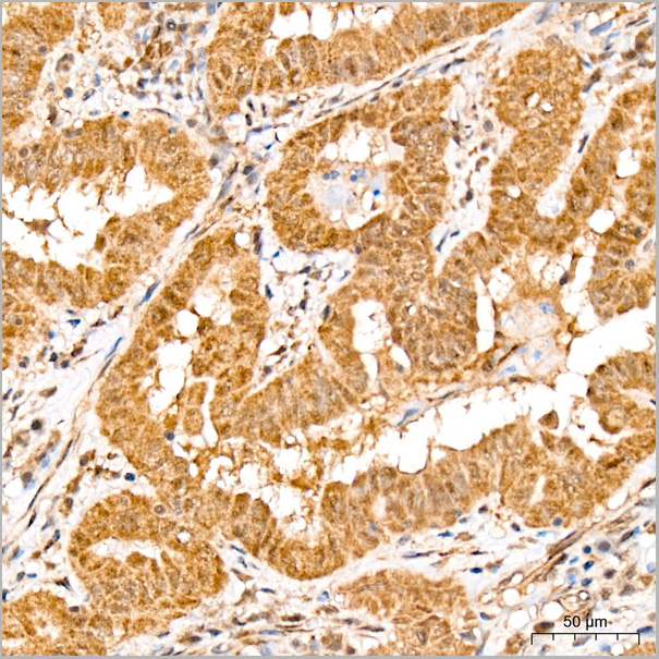 product-image-AAA28527_IHC2.jpg