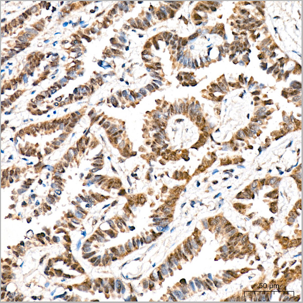 product-image-AAA28527_IHC3.jpg
