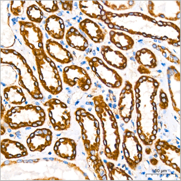product-image-AAA28529_IHC5.jpg