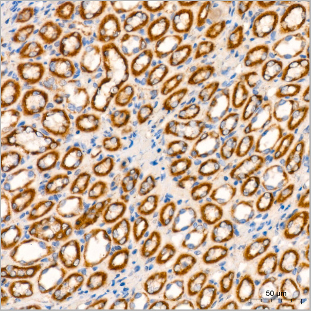 product-image-AAA28529_IHC8.jpg