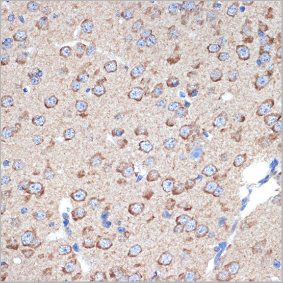 product-image-AAA28530_IHC4.jpg