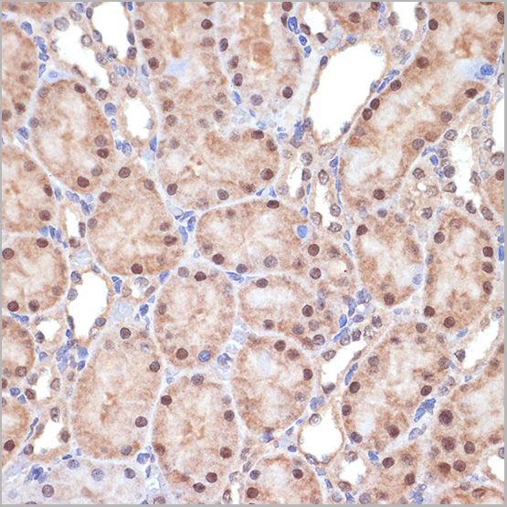 product-image-AAA28531_IHC2.jpg