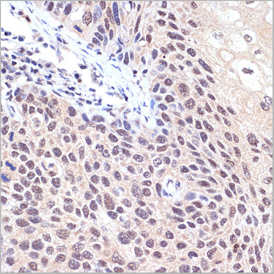 product-image-AAA28531_IHC3.jpg