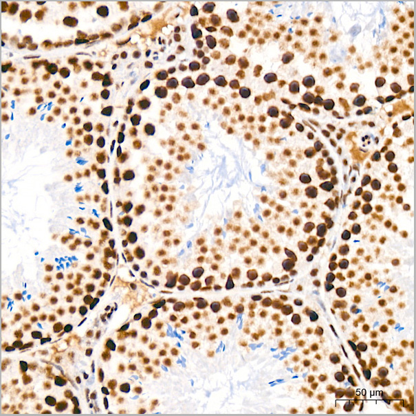 product-image-AAA28534_IHC6.jpg