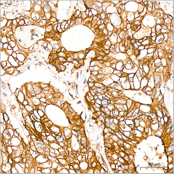 product-image-AAA28535_IHC2.jpg