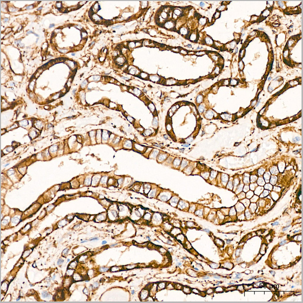 product-image-AAA28535_IHC5.jpg