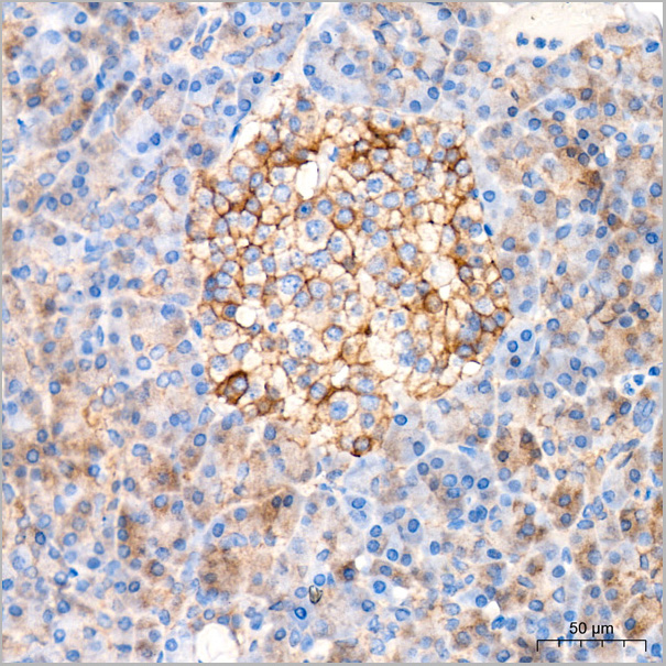 product-image-AAA28537_IHC3.jpg