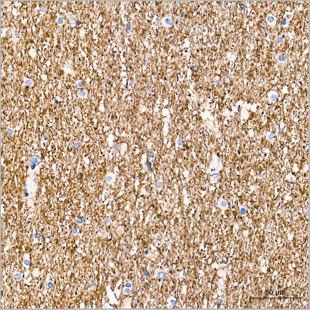 product-image-AAA28537_IHC5.jpg
