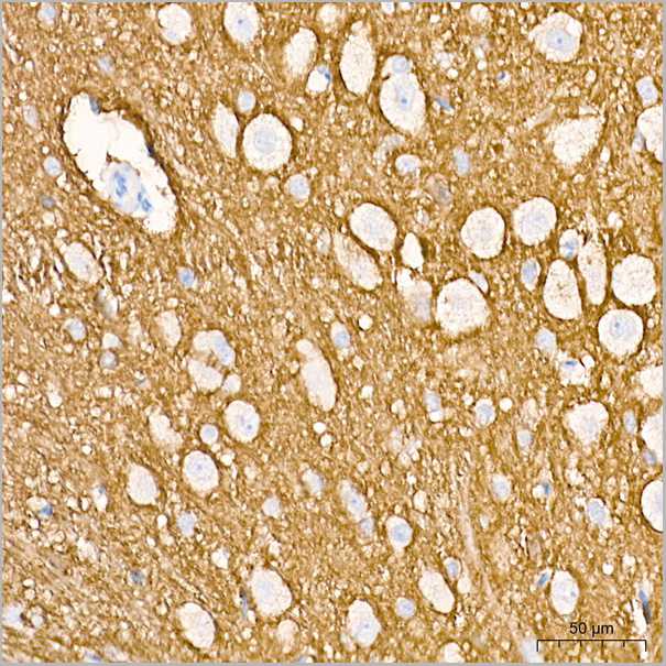 product-image-AAA28537_IHC8.jpg