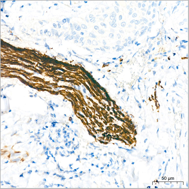 product-image-AAA28541_IHC2.jpg