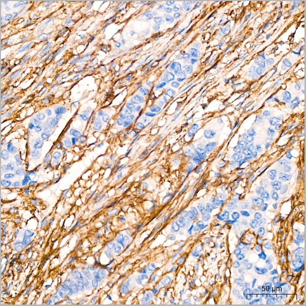 product-image-AAA28547_IHC2.jpg