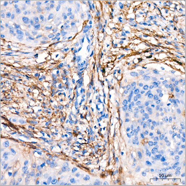 product-image-AAA28547_IHC4.jpg