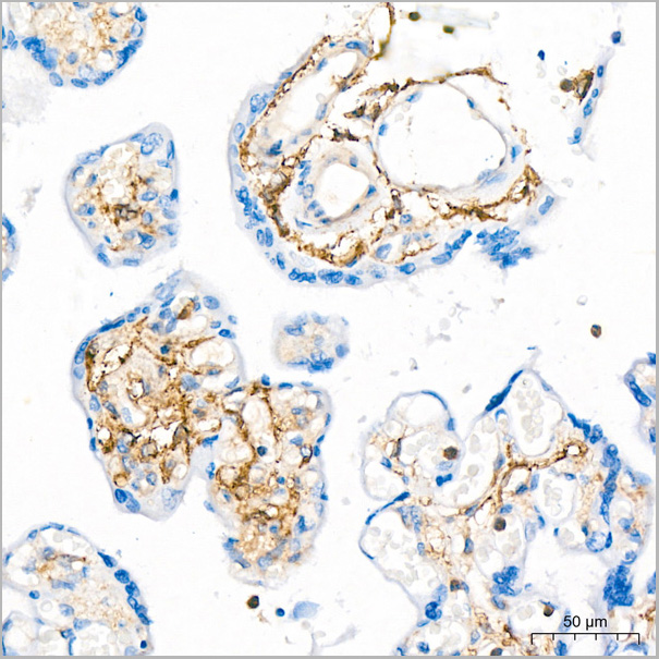 product-image-AAA28547_IHC8.jpg