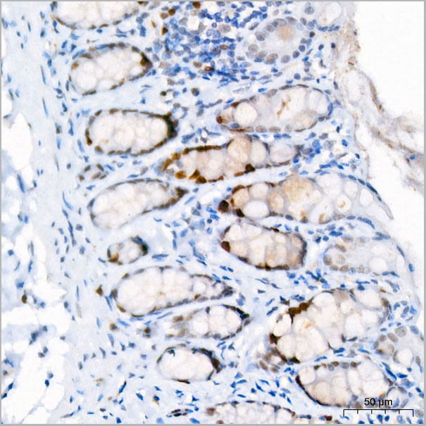 product-image-AAA28548_IHC5.jpg