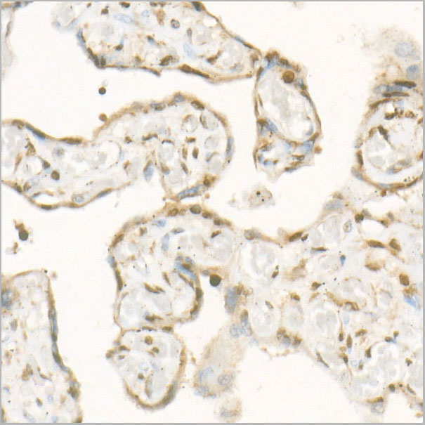 product-image-AAA28551_IHC2.jpg