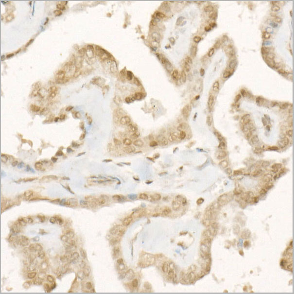 product-image-AAA28551_IHC3.jpg