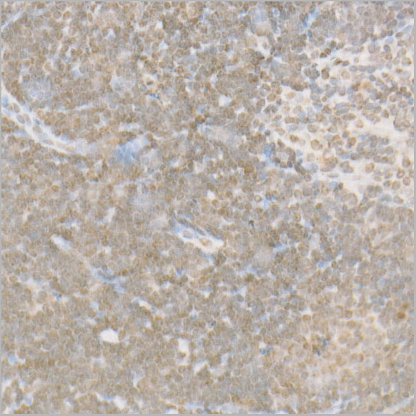 product-image-AAA28551_IHC4.jpg