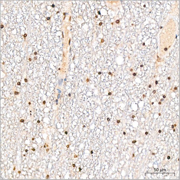 product-image-AAA28551_IHC5.jpg