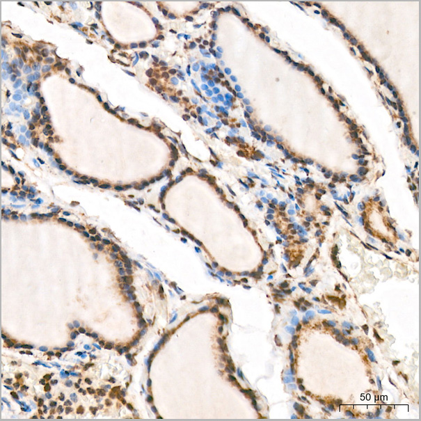 product-image-AAA28551_IHC8.jpg