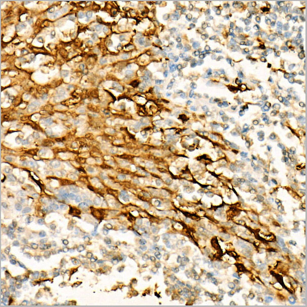 product-image-AAA28553_IHC4.jpg