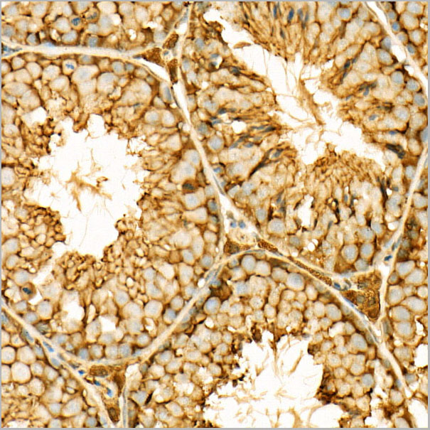 product-image-AAA28553_IHC5.jpg