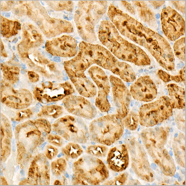product-image-AAA28553_IHC6.jpg