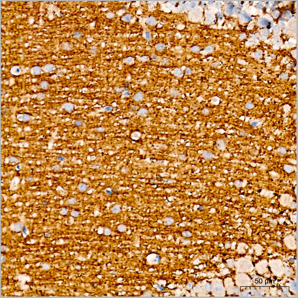 product-image-AAA28554_IHC3.jpg