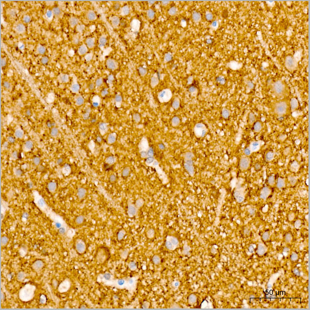 product-image-AAA28554_IHC4.jpg