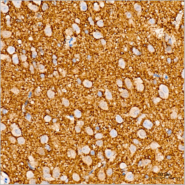 product-image-AAA28554_IHC5.jpg