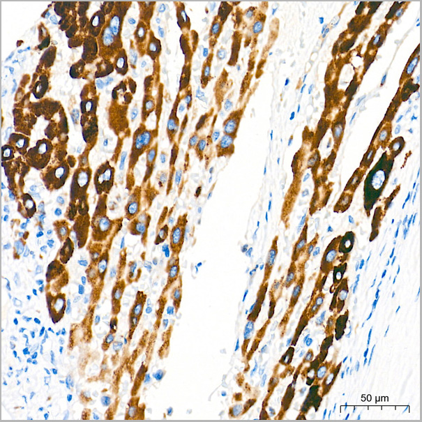 product-image-AAA28557_IHC4.jpg