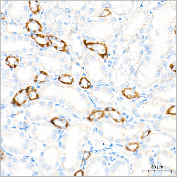 product-image-AAA28557_IHC7.jpg