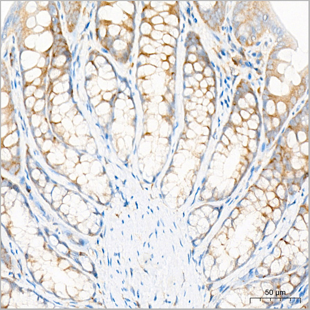 product-image-AAA28560_IHC3.jpg