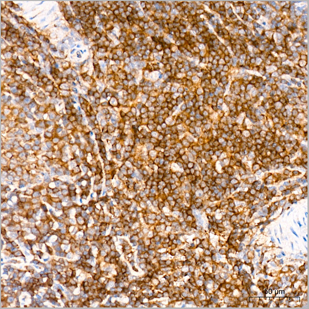 product-image-AAA28560_IHC4.jpg