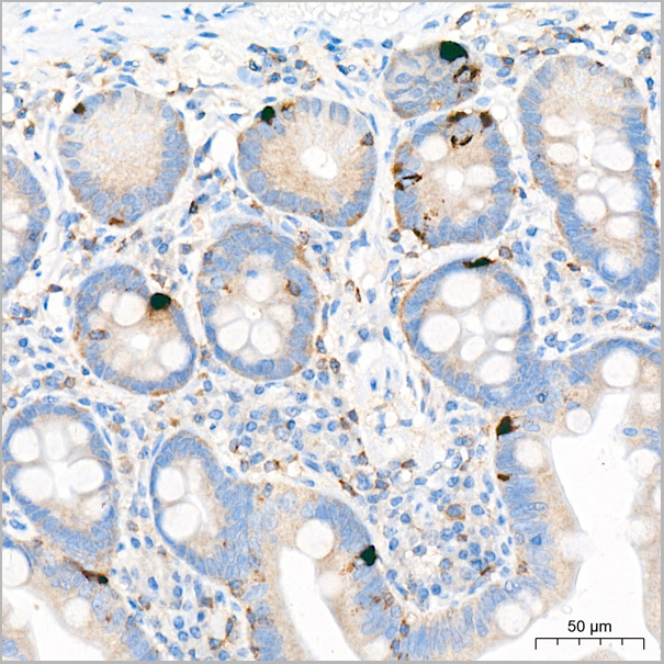 product-image-AAA28560_IHC6.jpg