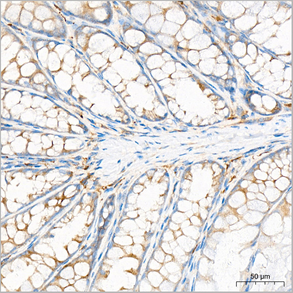 product-image-AAA28560_IHC7.jpg
