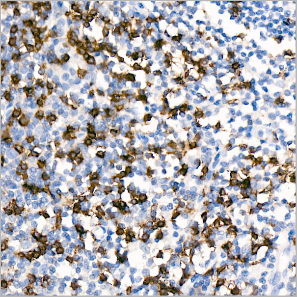 product-image-AAA28561_IHC4.jpg