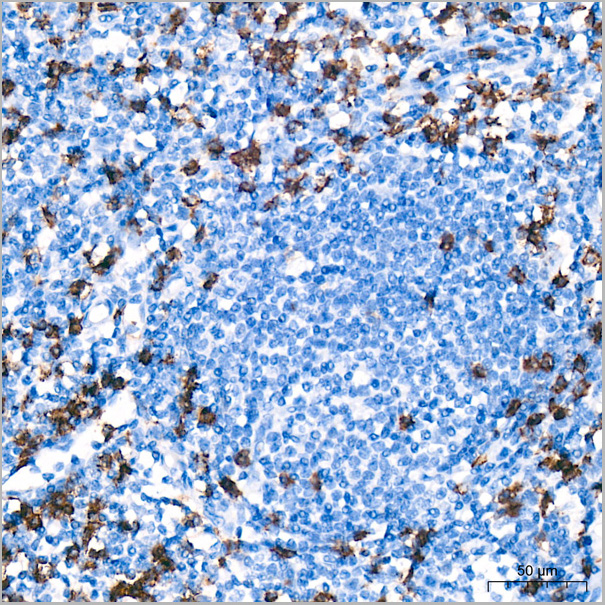 product-image-AAA28561_IHC5.jpg
