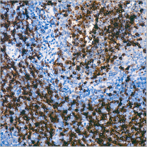 product-image-AAA28561_IHC6.jpg