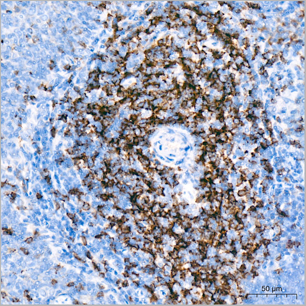 product-image-AAA28561_IHC7.jpg