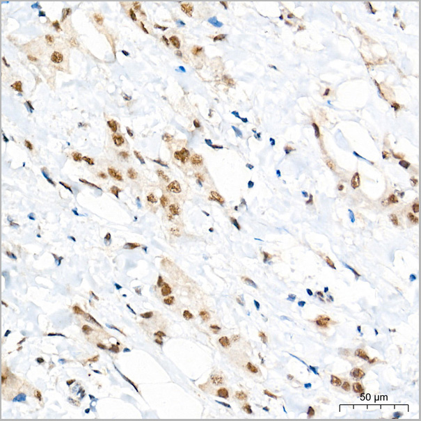 product-image-AAA28563_IHC4.jpg