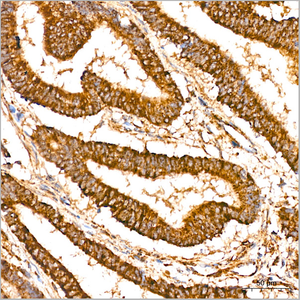 product-image-AAA28565_IHC3.jpg