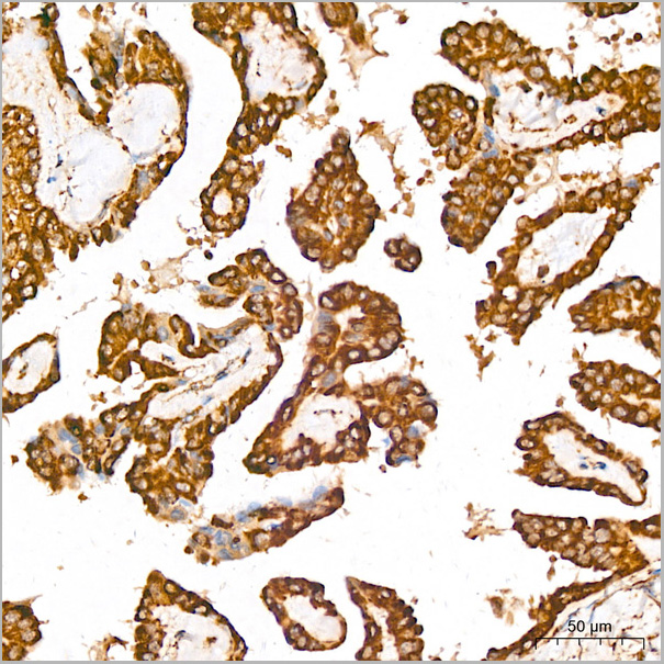 product-image-AAA28565_IHC5.jpg