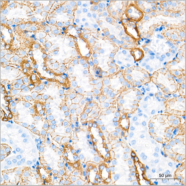 product-image-AAA28570_IHC3.jpg