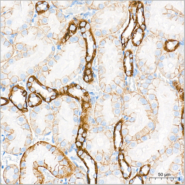 product-image-AAA28570_IHC5.jpg