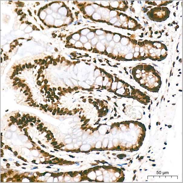 product-image-AAA28571_IHC5.jpg