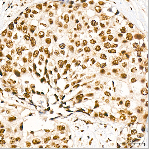 product-image-AAA28572_IHC2.jpg